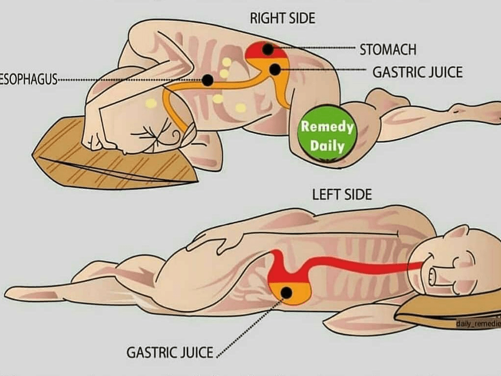 Sleeping on Left side